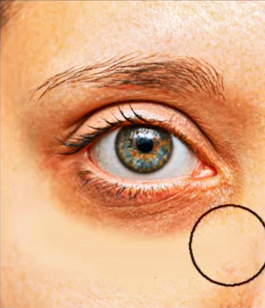 Free Eye Dark Spot Image Varanasi Best